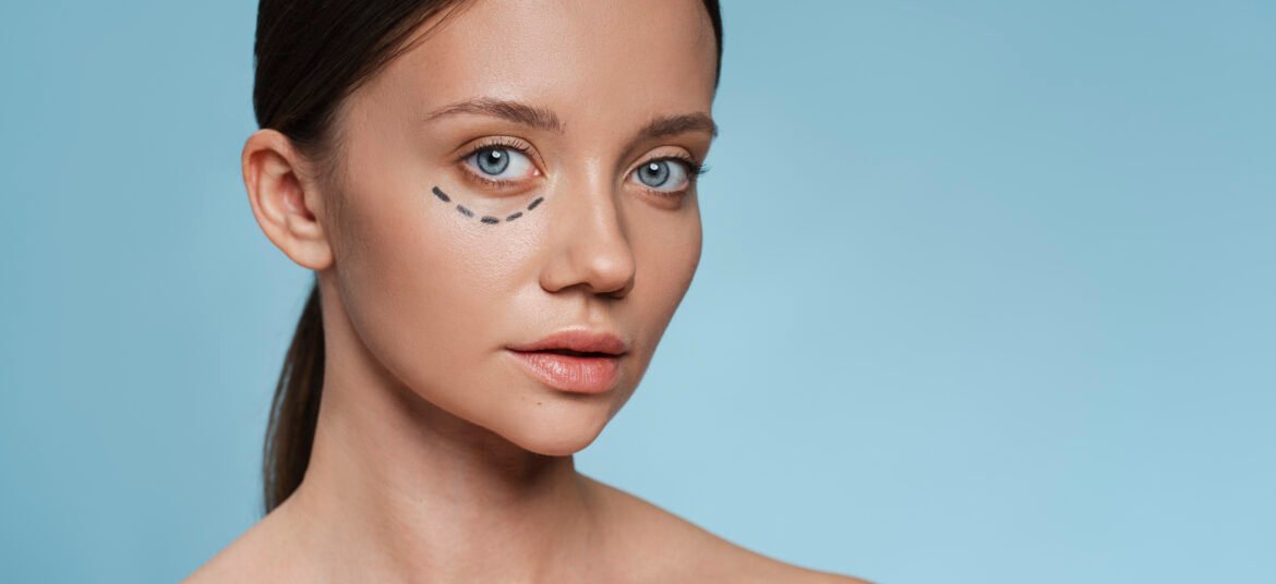 Πορτραίτο γυναίκας με σημάδια για να προχωρήσει σε βλεφαροπλαστική με laser